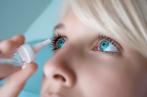 DryEyes